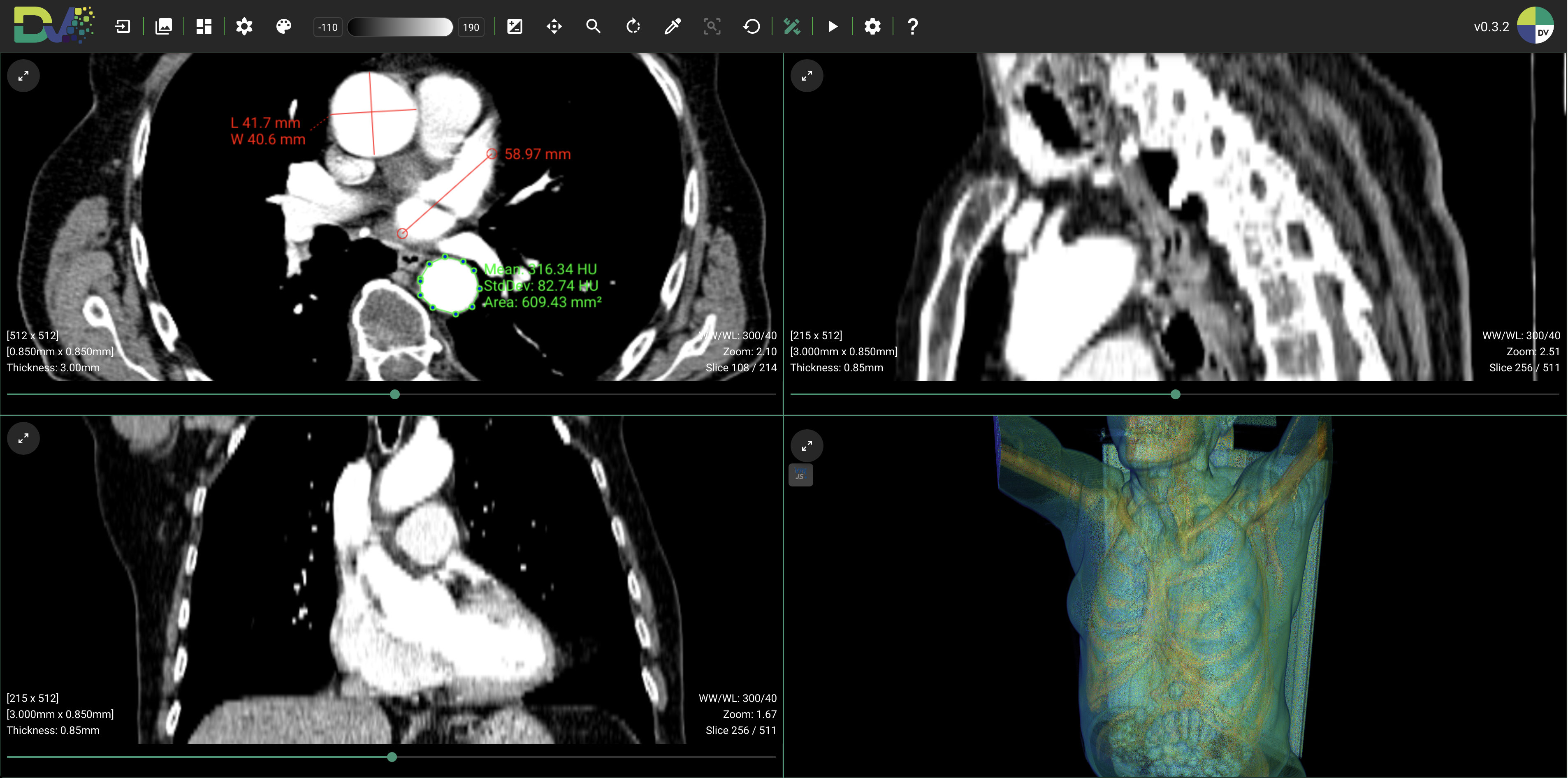 DICOM Vision