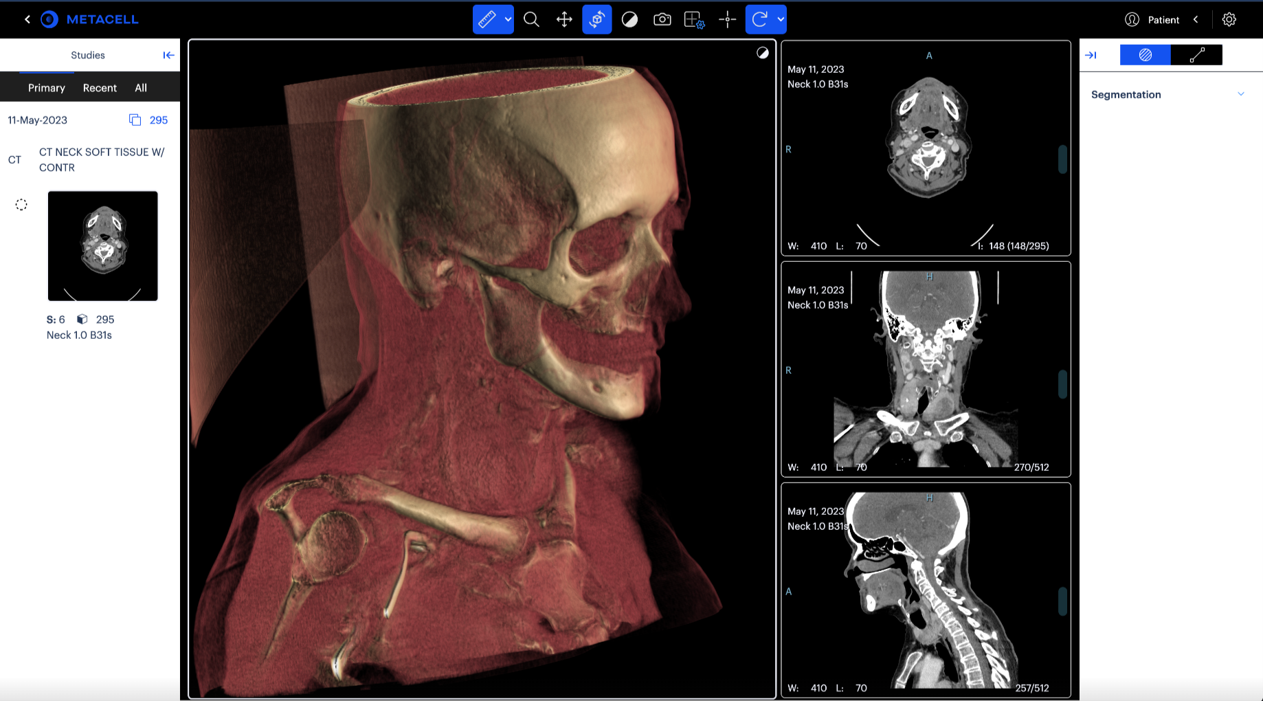 MetaCell Neuroglass Cloud Visualiser