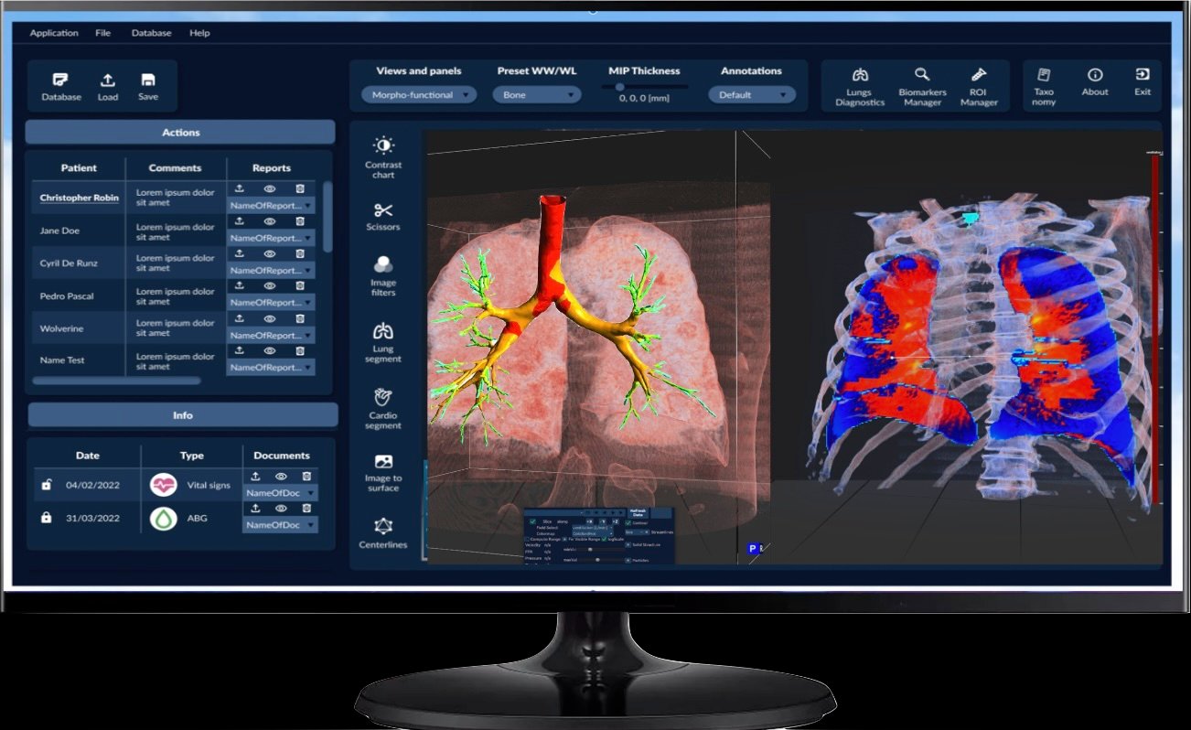 MedLea: Predictive Pulmonary Health